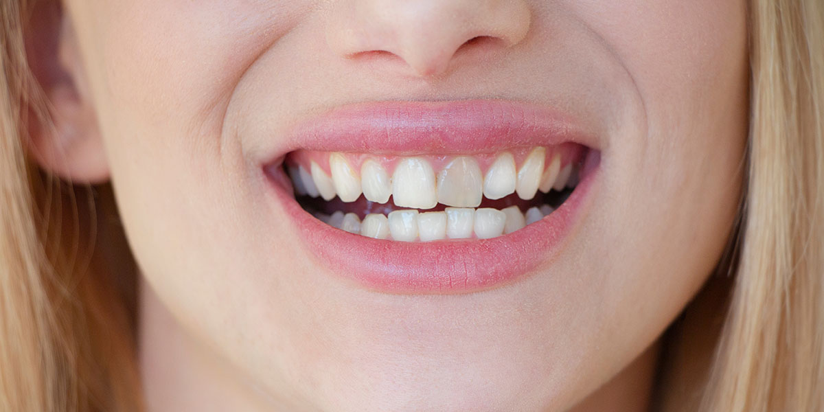 Потемнел зуб: причины и лечение