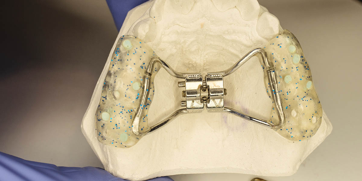 Аппарат Дерихсвайлера: для чего применяется в ортодонтии