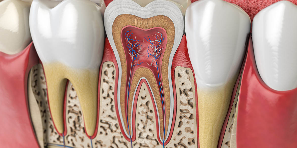 Кариес зубов | Стоматология Митино