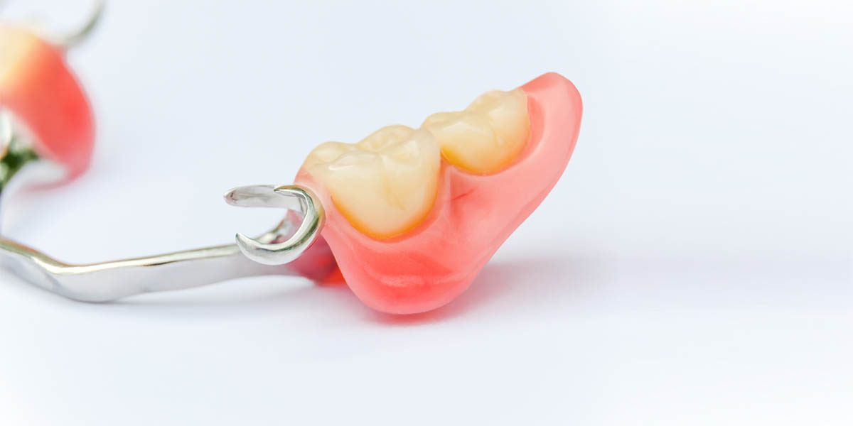 Натирают зубные протезы? Полезные советы стоматолога