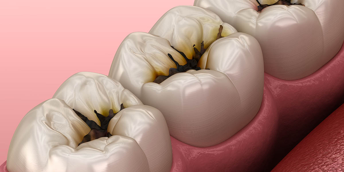 Как снять зубную боль – обзор народных средств