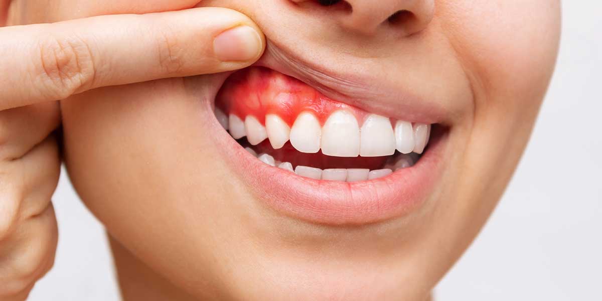 Болит зуб при накусывании: стоматолог объяснила, в чем может быть причина | DOCTORPITER