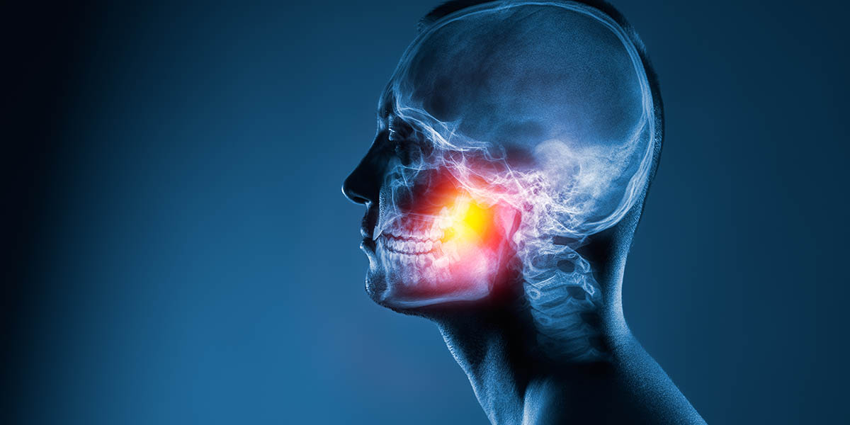 Остеонекроз челюсти - причины, симптомы, признаки, лечение