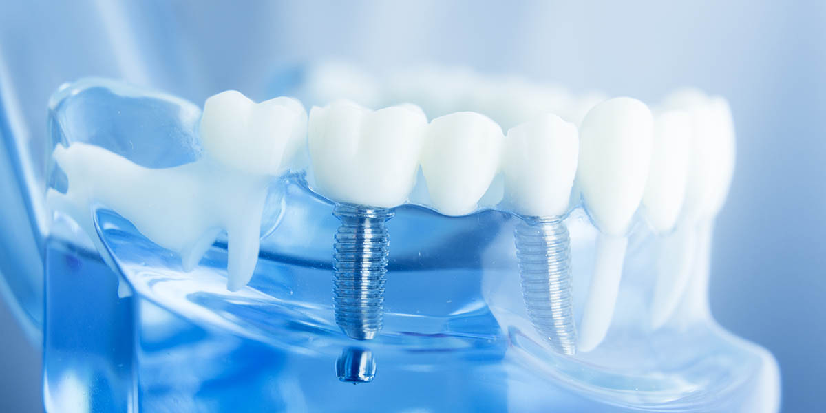 Лечение зубов у пациентов с онкологическими заболеваниями