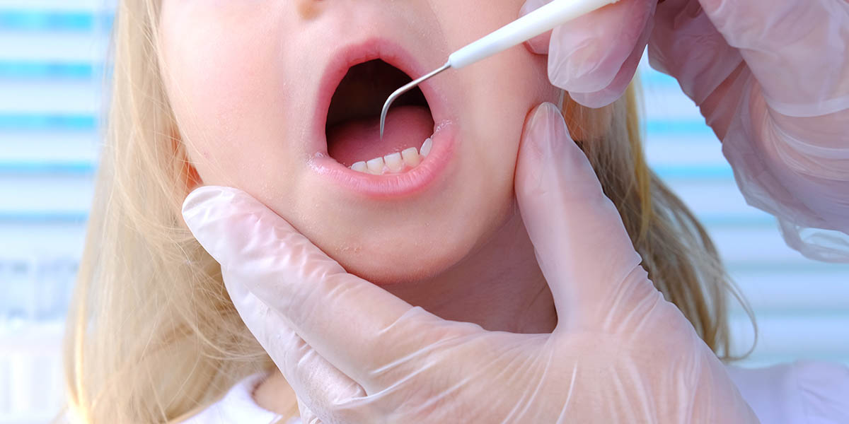 Чернеют зубы у ребенка