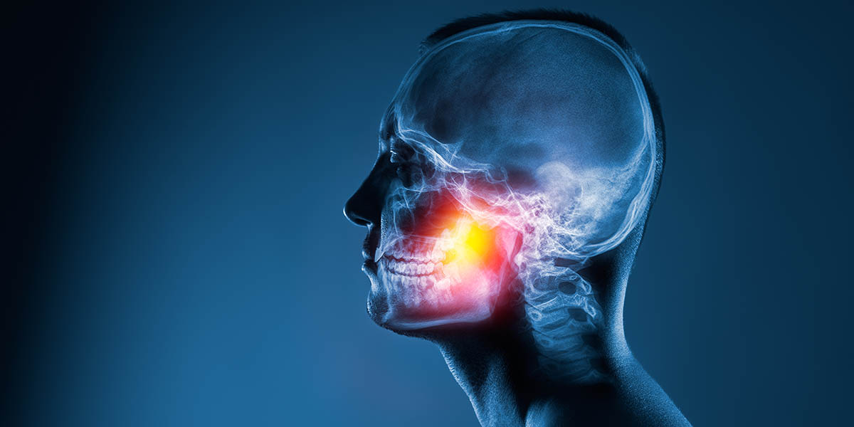 Лезет зуб мудрости, что делать: болит десна и опухла щека – стоматология ПрезиДЕНТ