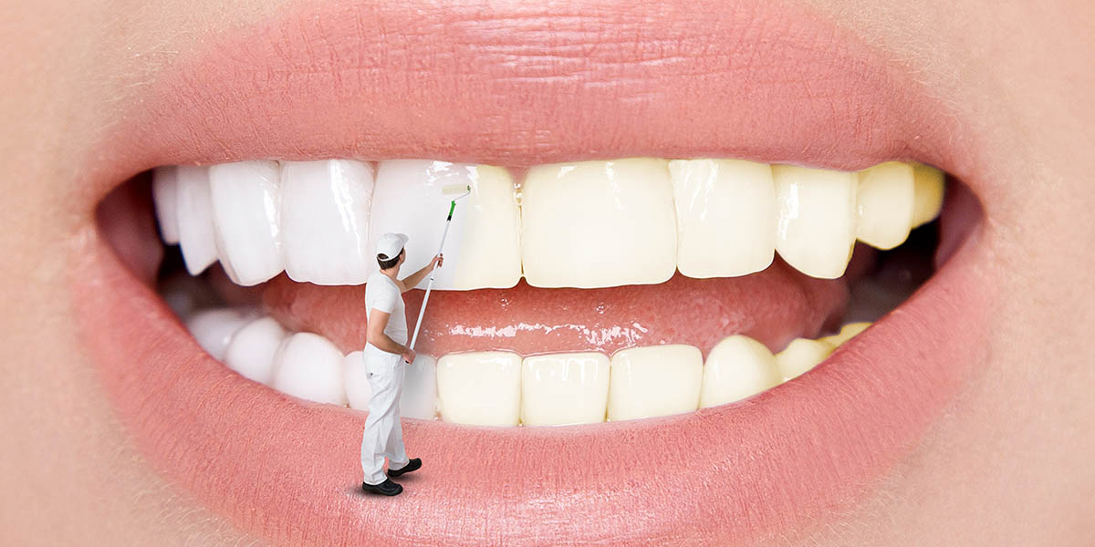 25 лучших и эффективных методов отбеливания зубов в домашних условиях