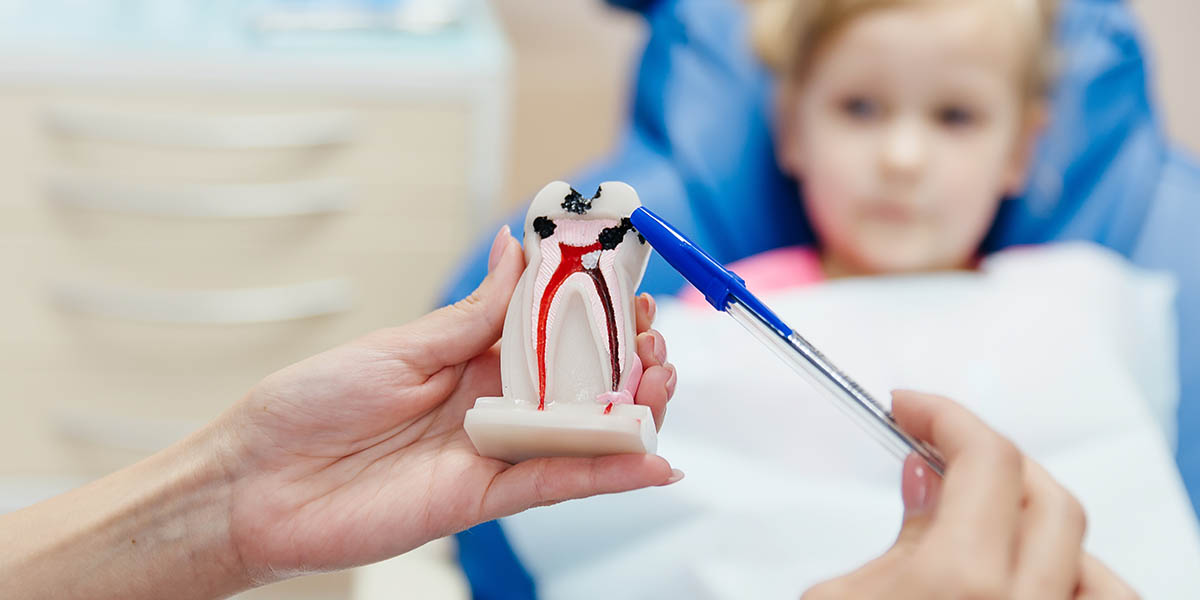 Кариес молочных зубов: причины, стадии, лечение