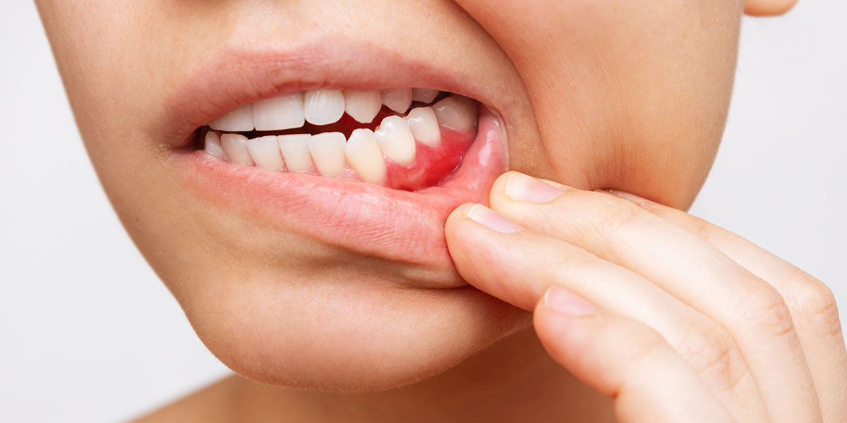 Почему этот зуб нельзя лечить? Молочные зубы со свищем