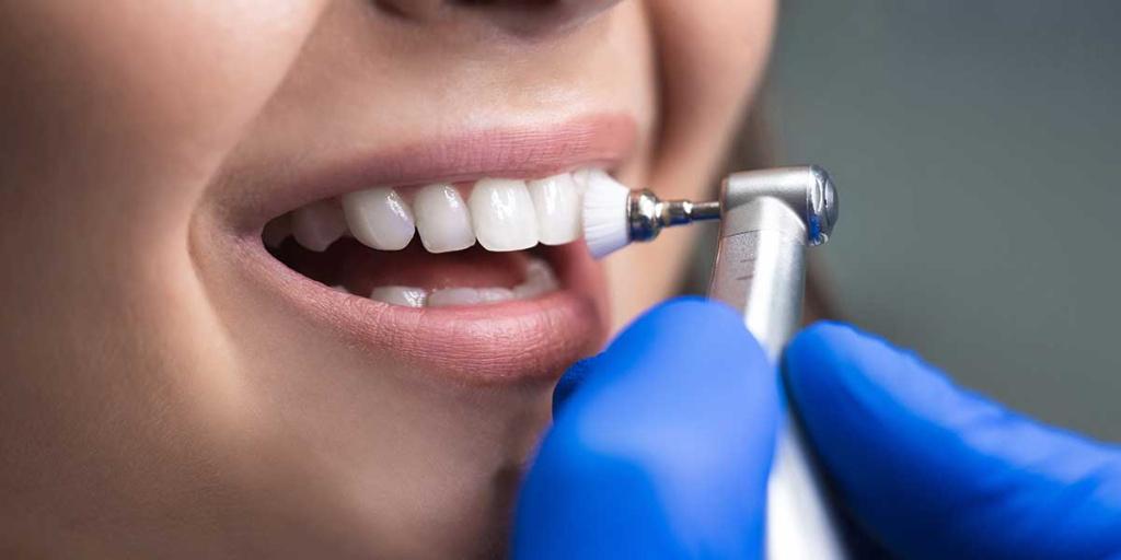 Восстановление эмали зубов