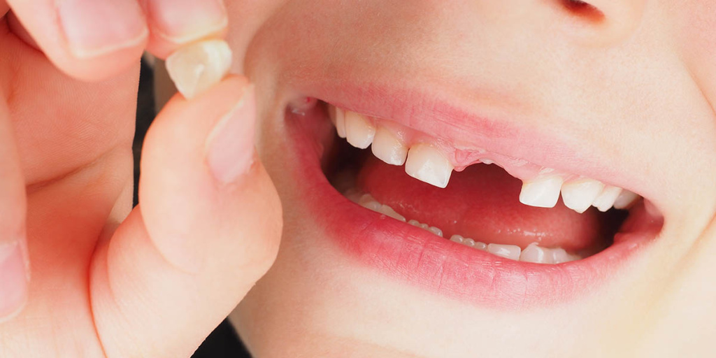 Когда выпадают молочные зубы — Клиника Лукашука