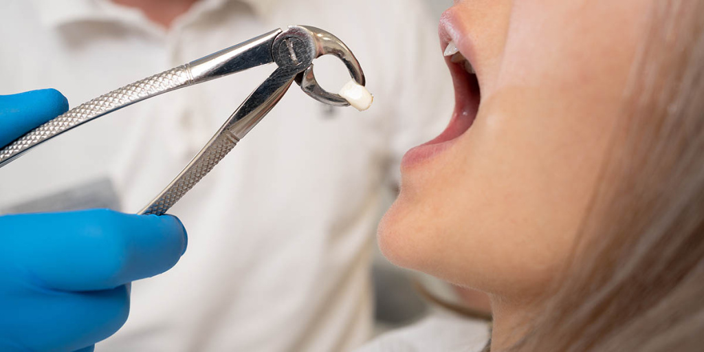 Почему глотать больно после удаления зуба мудрости: причины и способы облегчения