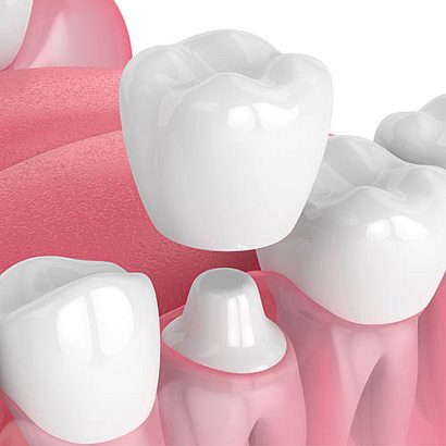 Болит зуб под коронкой – болит после лечения или через год, что делать