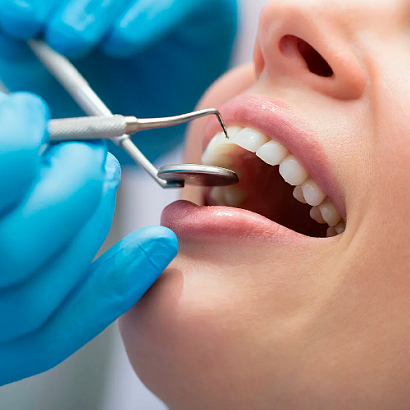 Сколько стоит запломбировать зуб в Дентру?