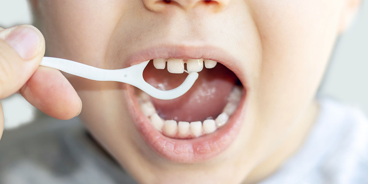 Застревает еда между зубами: причины и лечение