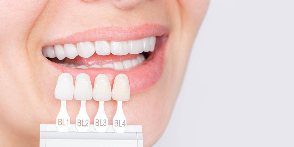 Что делать, чтобы зубы были белыми